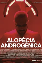 Alopècia androgènica постер