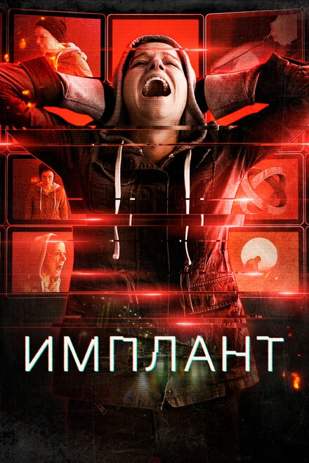 Постер Имплант 2021